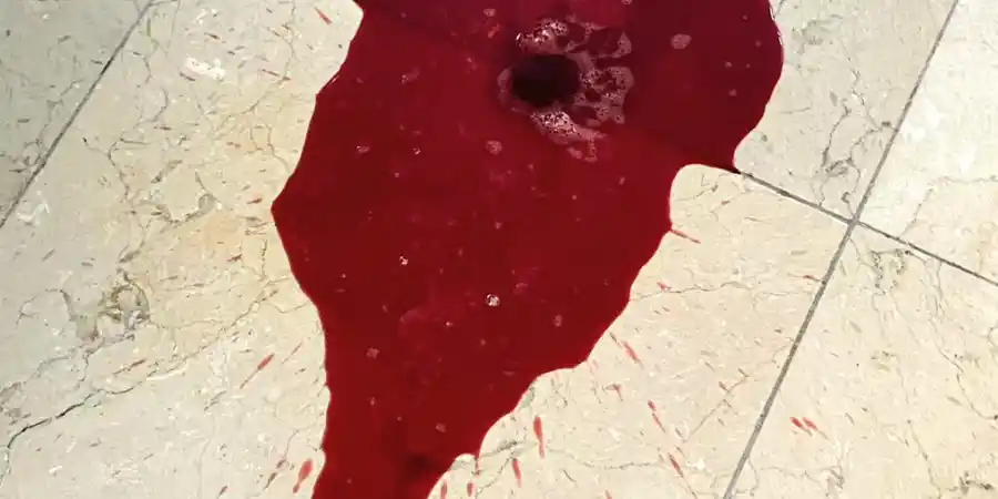 Dog Is Pooping Pure Blood